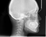 DentScan Imaging Centre- Digital Dental x ray| CBCT services Vadodara