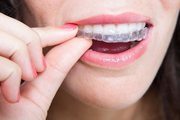 Invisible Braces in ahmedabad | invisalign Treatment - Vyom Dental