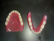 Removable Complete Denture