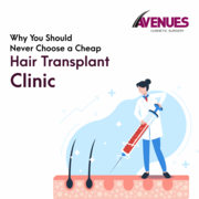 Most Affordable Hair Transplant in Ahmedabad,  Avenues Cosmetic.