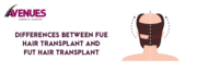 Differences Between Fue and Fut Hair Transplant