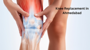 If you are looking for knee replacement in Ahmedabad