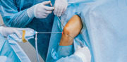 Leading Arthroscopy Surgeon Ranchi for Joint Pain and Injuries