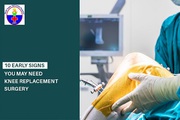 Looking for signs you may need knee replacement surgery