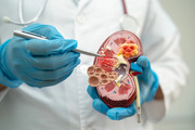 Consult the Best Onco Surgeon in Gota