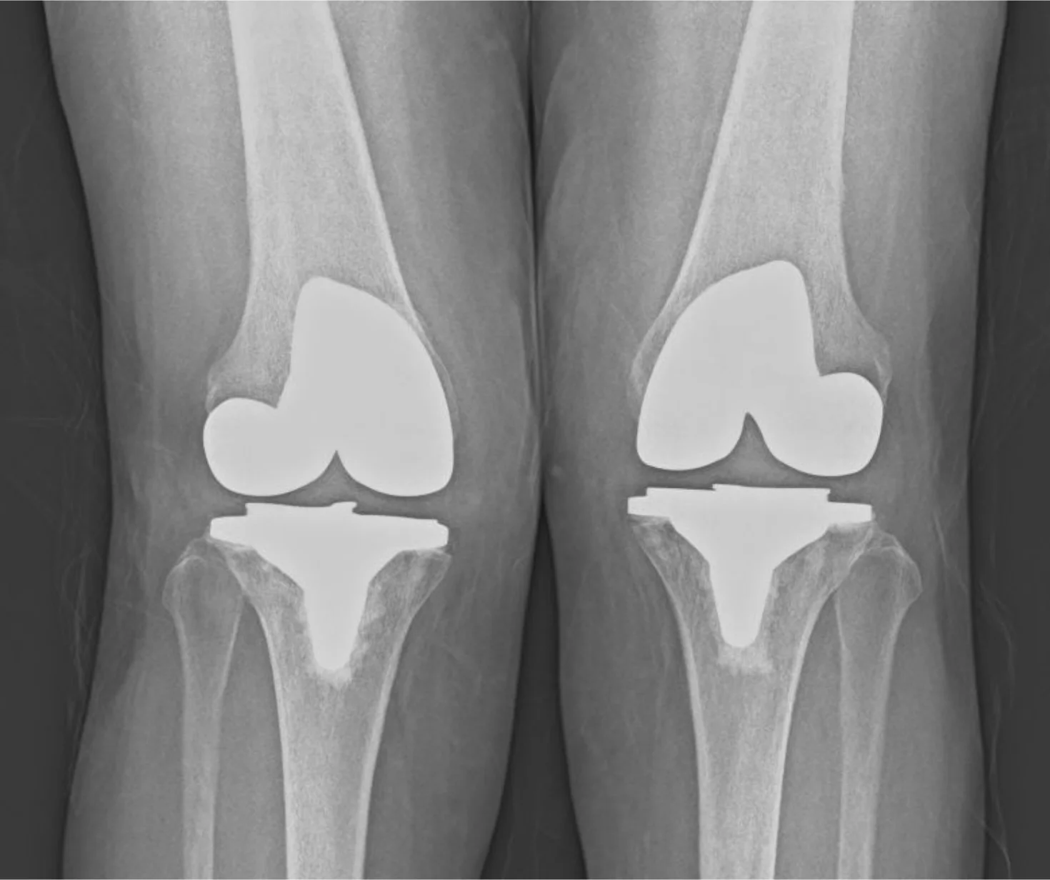 Experienced Orthopedic Surgeon in Faridabad